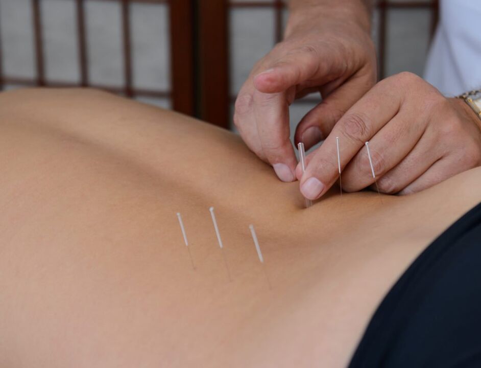 prostatitisaren akupuntura