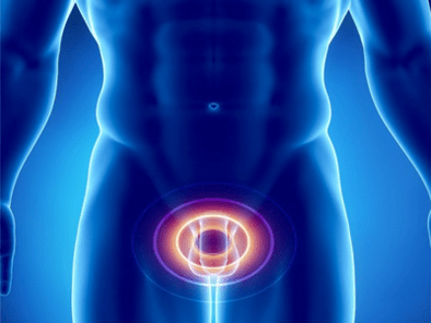 Prostatitis - gizon baten prostatako guruinaren hantura